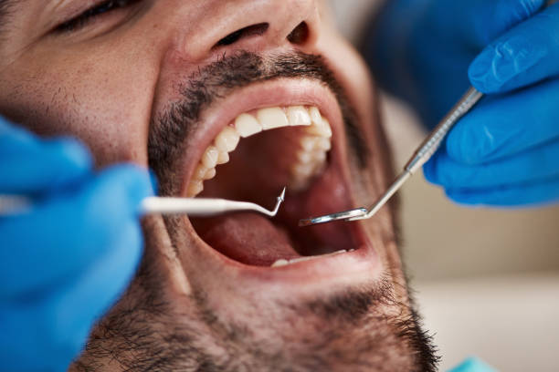 Best Emergency Cosmetic Dentistry in Norton Shores, MI