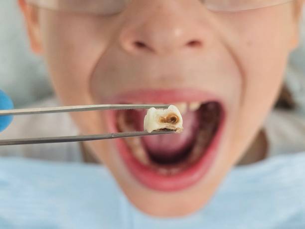 Best Pediatric Emergency Dentist in Norton Shores, MI